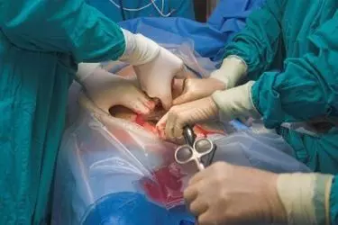 best hospital for normal delivery in Purnia, best doctor for normal delivery in Purnia, cost of normal delivery in Purnia