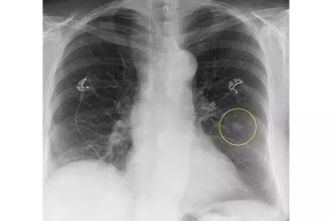 best hospital for digital x-ray test in purnia, best doctor for digital x-ray test in purnia, cost of digital x-ray test in purnia